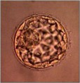 /album/photogallery/a20-year-old-frozen-embryo-becomes-baby-britain-science-embryos-7960-jpg/