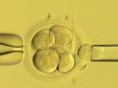 /album/photogallery/ivf-400-685889c-jpg/